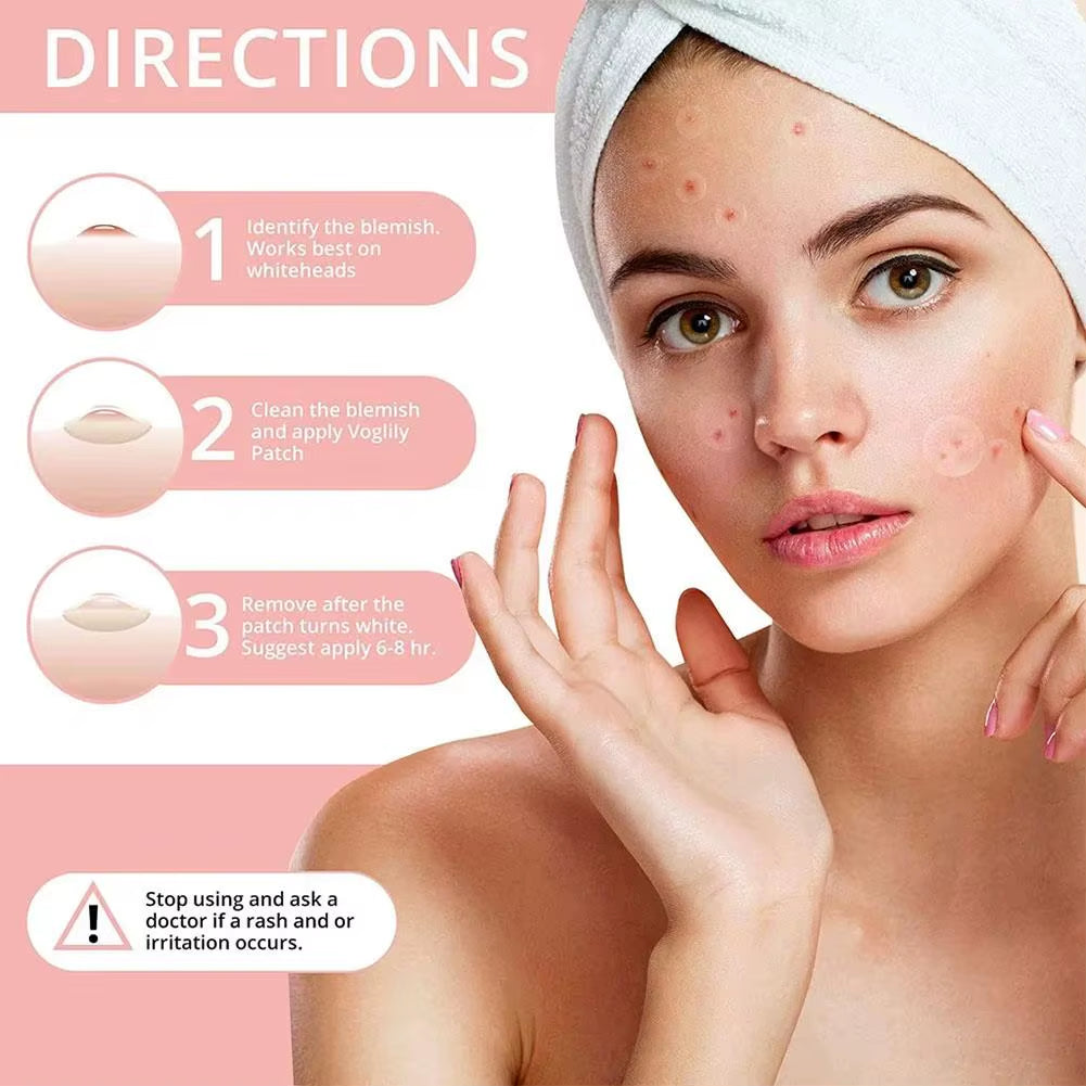 72Pcs Invisible Salicylic Acid Acne Patches Anti-Acne Spot Treatment, Waterproof Pimple Concealer, Repair Stickers for Blemish