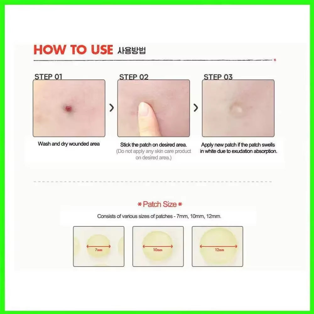 24Pcs Face Acne Pimple Spot Facial Skin Care Blackhead Removal Freckle Patches Scar Care Treatment Stickers Acne Mask Beauty