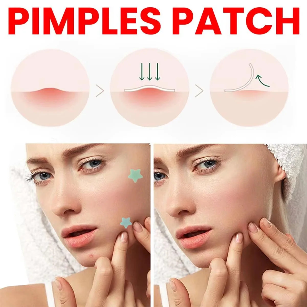 200Pcs Star Acne Pimple Patches Colorful Breathable Removal Pimple Absorb Secretions anti Infection Concealer Makeup Skin Care