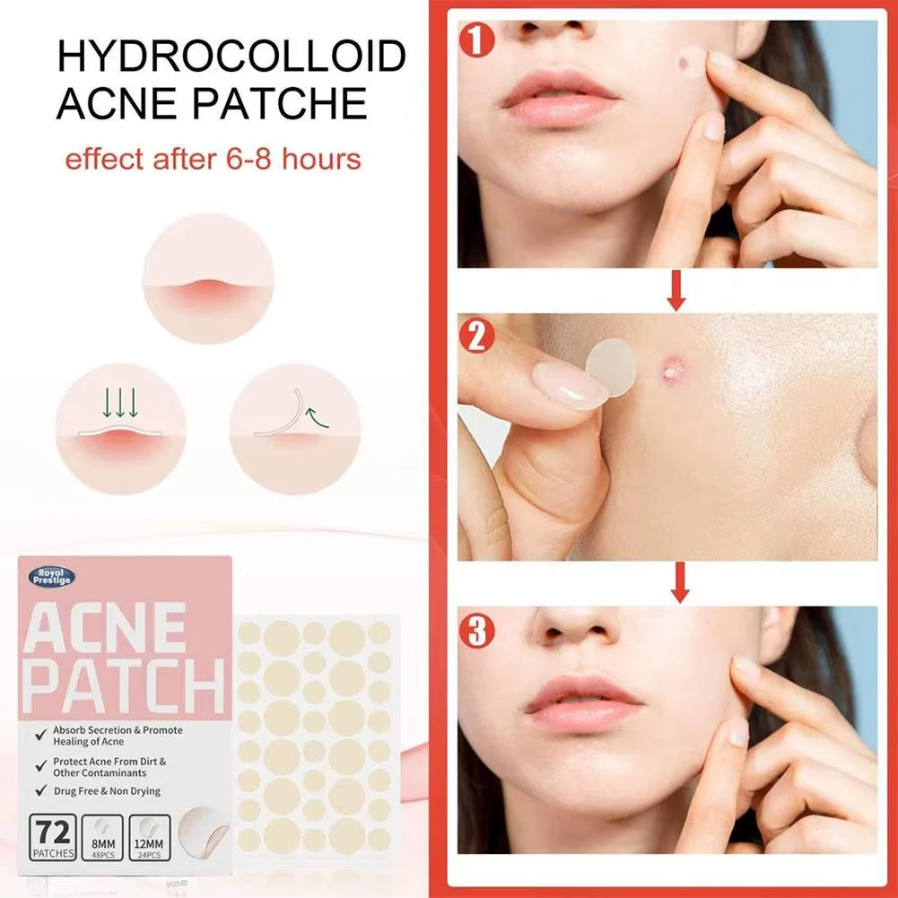 72Pcs Invisible Salicylic Acid Acne Patches Anti-Acne Spot Treatment, Waterproof Pimple Concealer, Repair Stickers for Blemish