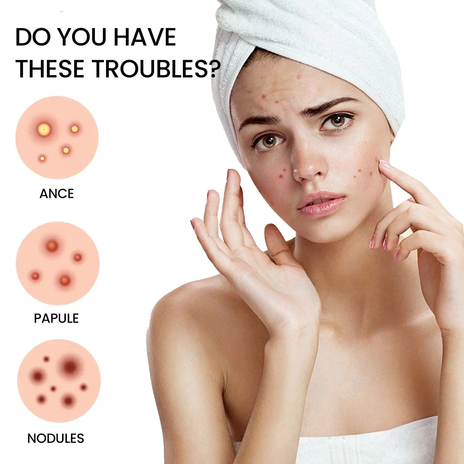 Repair Acne Patch,200Patches