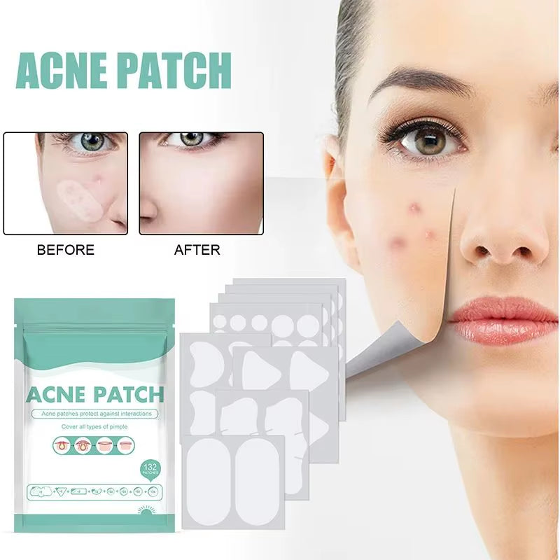 Acne Mask Patch Facial Treatment Desalinate Pimple Marks Pimple Patch Mild and Non-Irritating Healing Acne Acne Repair Patch