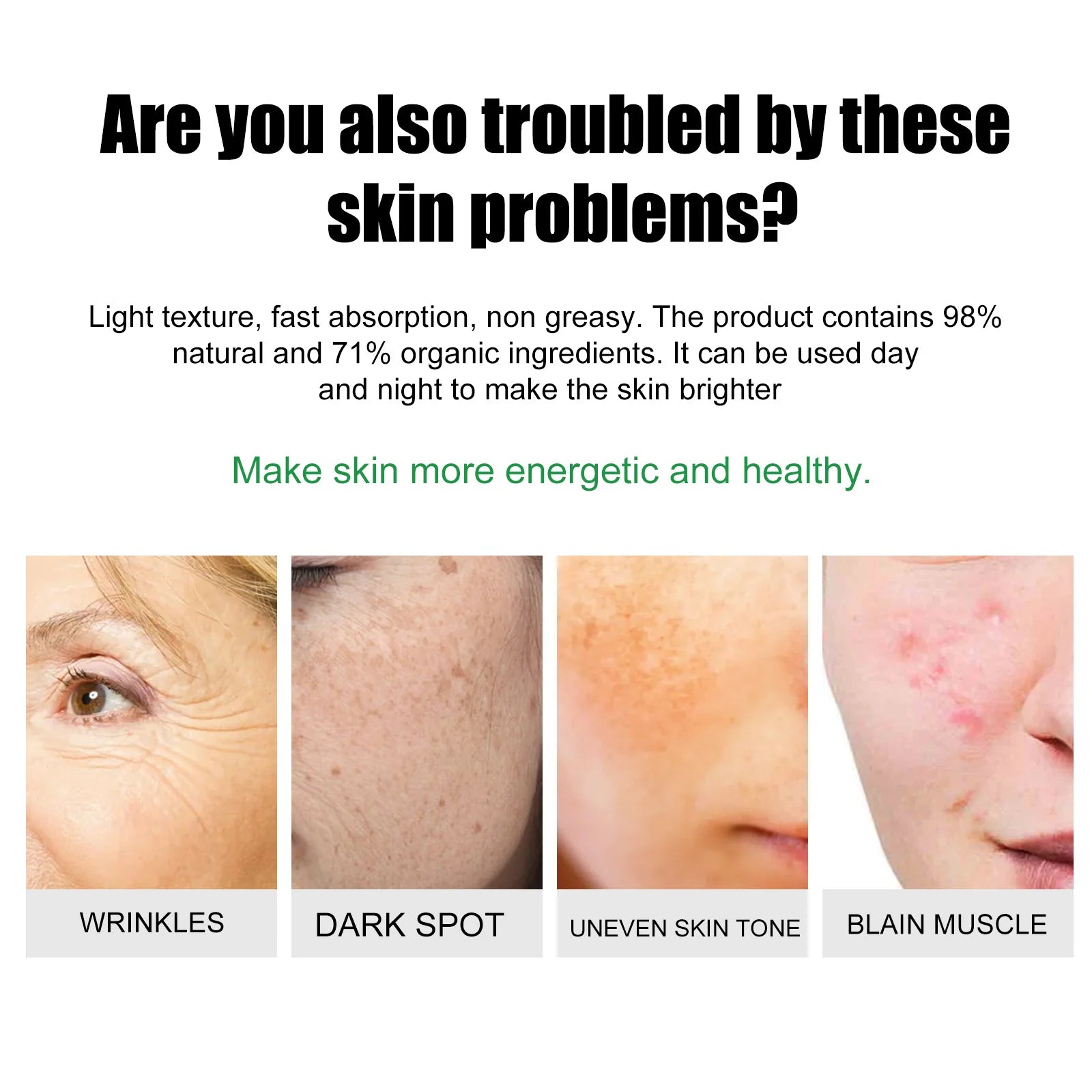 EELHOE Acne & Blemish Cream Lightens Blemishes & Acne Brightens Skin Complexion Moisturizing Skin Repair Cream