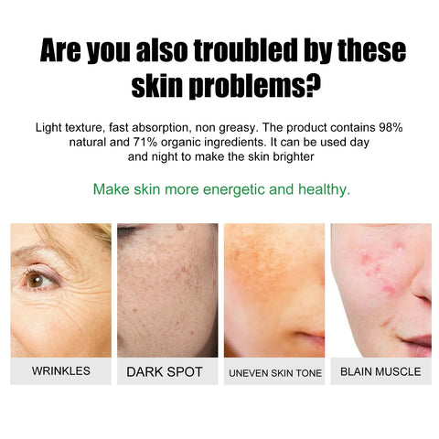 EELHOE Acne & Blemish Cream Lightens Blemishes & Acne Brightens Skin Complexion Moisturizing Skin Repair Cream