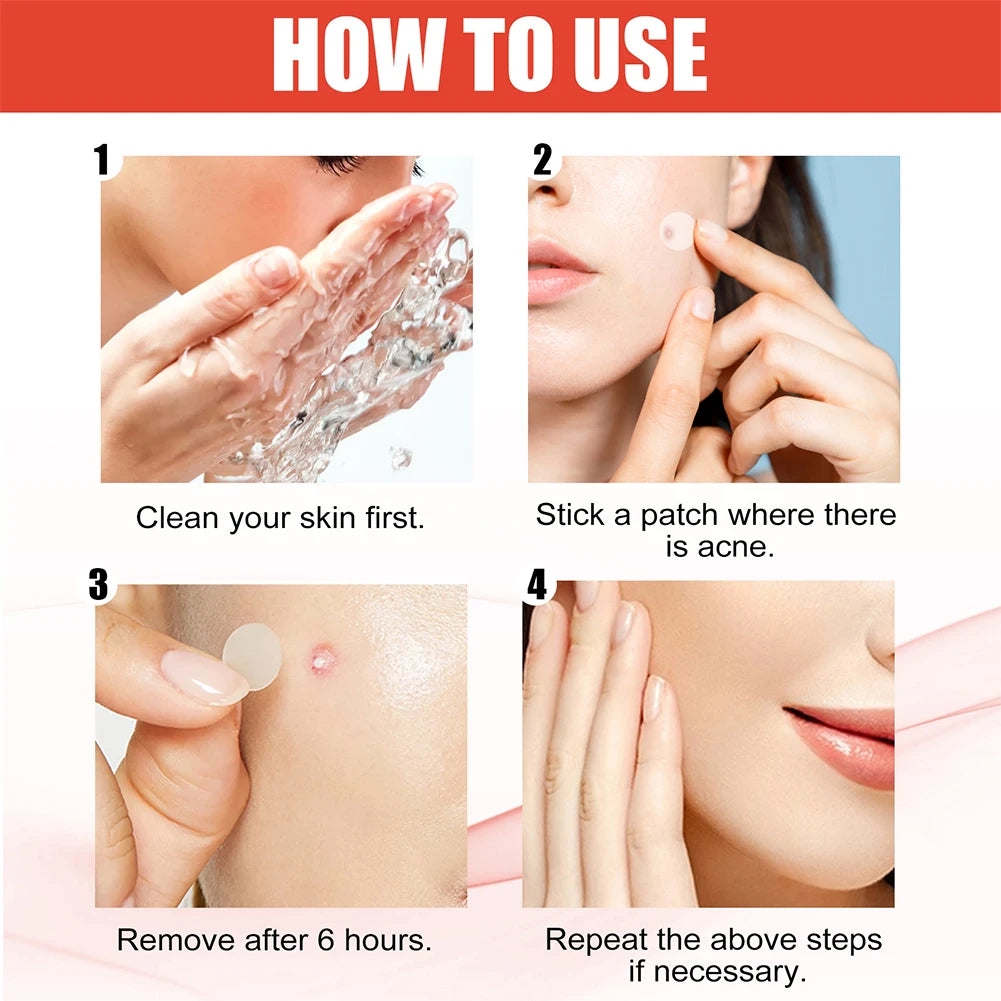 200Pcs Star Acne Pimple Patches Colorful Breathable Removal Pimple Absorb Secretions anti Infection Concealer Makeup Skin Care