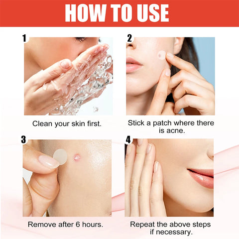 200Pcs Star Acne Pimple Patches Colorful Breathable Removal Pimple Absorb Secretions anti Infection Concealer Makeup Skin Care