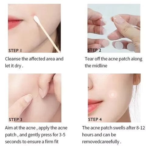 LANBENA Repair Acne Patch Facial Skin Care Fade Blemishes Pimple Marks Closed Acne Blemishes Cover Acne Pimple Repair Patch