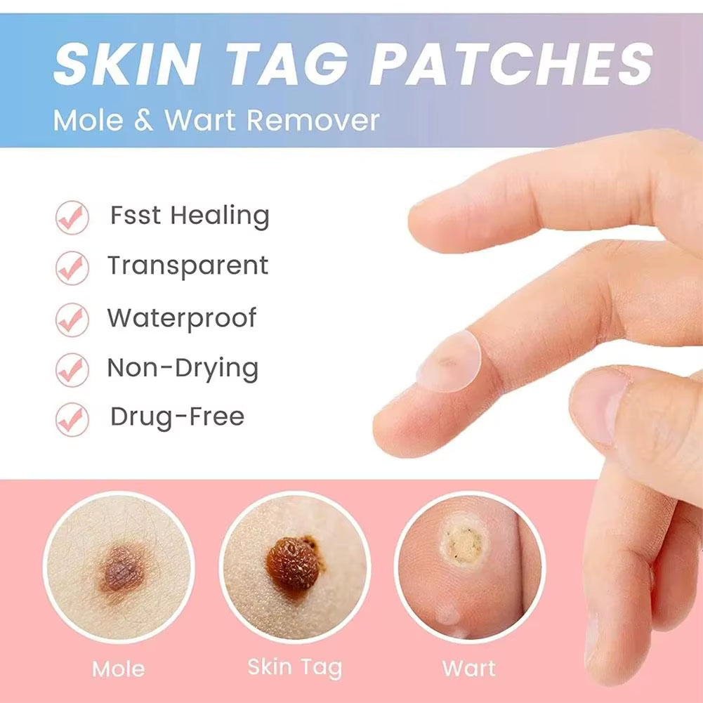 72Pcs Invisible Salicylic Acid Acne Patches Anti-Acne Spot Treatment, Waterproof Pimple Concealer, Repair Stickers for Blemish