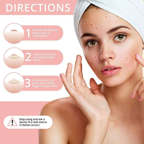 72Pcs Invisible Salicylic Acid Acne Patches Anti-Acne Spot Treatment, Waterproof Pimple Concealer, Repair Stickers for Blemish
