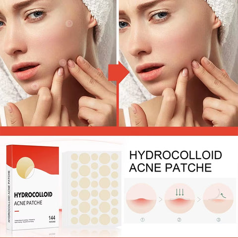 144Pcs Face Acne Patch Invisible Skin Care Pimple Acne Patches Anti-Inflammatory Healing Absorbing Spot Sticker Covering Acne