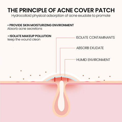 Repair Acne Patch,200Patches