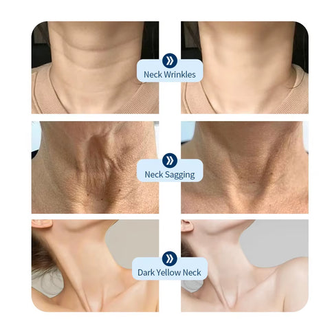 Neck LED Lift Mask Photon Anti-Wrinkle Skin Tightening Neck Beauty Device Skin Brighten Rejuvenation Neck Wrinkle Remover