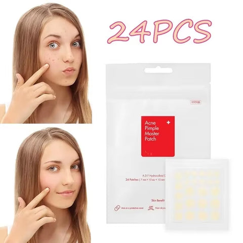 24Pcs Face Acne Pimple Spot Facial Skin Care Blackhead Removal Freckle Patches Scar Care Treatment Stickers Acne Mask Beauty