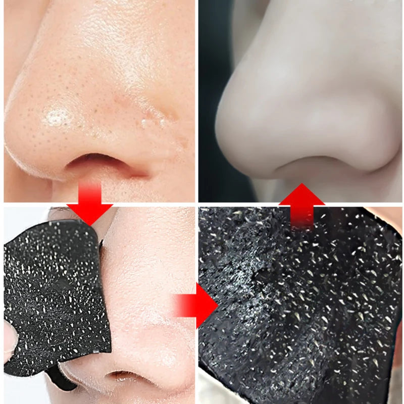 10/20/50/100 PCS Nose Strips for Blackheads Acne Removal Instant Pore Unclogging Strips Deep Cleansing Nose Clean Patch Strips