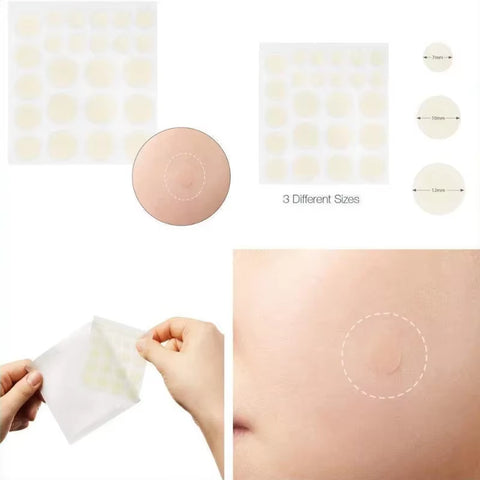 24Pcs Face Acne Pimple Spot Facial Skin Care Blackhead Removal Freckle Patches Scar Care Treatment Stickers Acne Mask Beauty