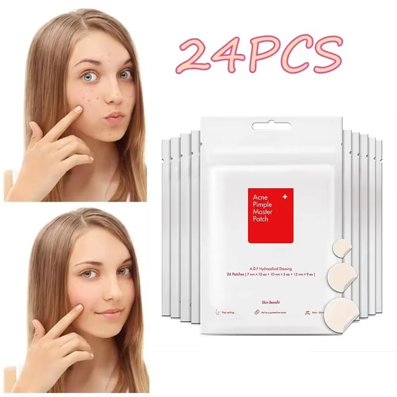 24Pcs Face Acne Pimple Spot Facial Skin Care Blackhead Removal Freckle Patches Scar Care Treatment Stickers Acne Mask Beauty