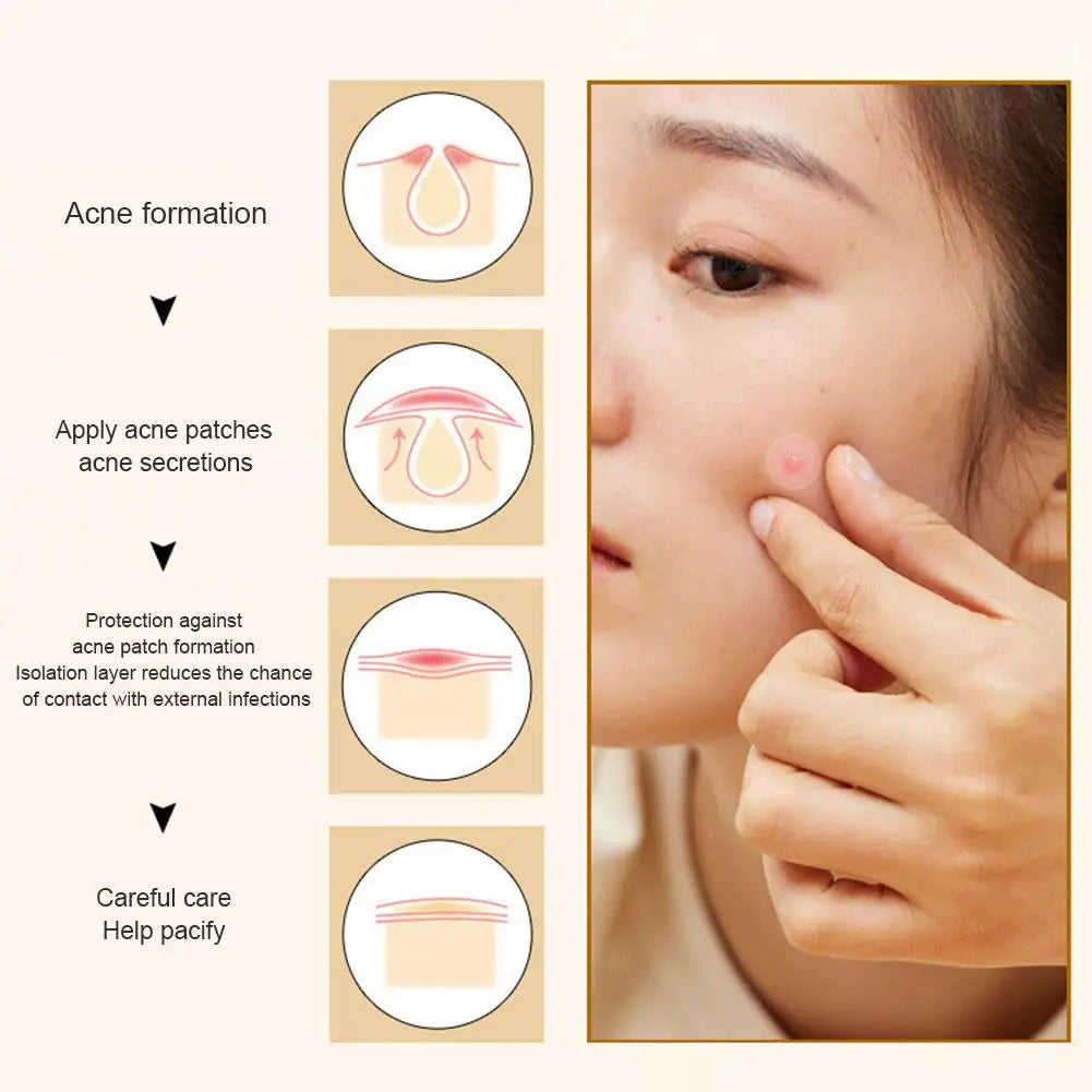 35/40Pcs Colorful Cute Star Heart Shaped Acne Treatment Sticker Invisible Acne Cover Pimple Patch Skin Care