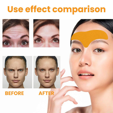 EELHOE Forehead Wrinkle Patch Lift and Smooth Forehead Wrinkles Facial Skin Forehead Patch
