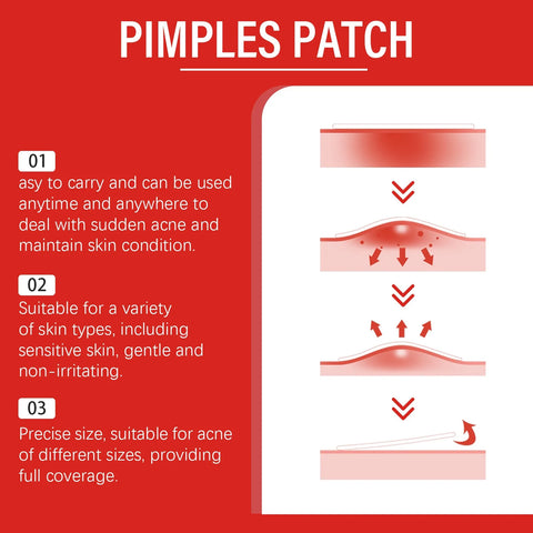 200Pcs Star Acne Pimple Patches Colorful Breathable Removal Pimple Absorb Secretions anti Infection Concealer Makeup Skin Care